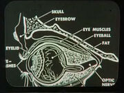 Eye diagram