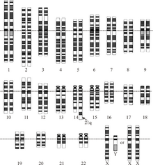 Down syndrome translocation