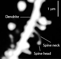 Spines