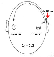 BONE CONDUCTION