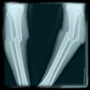 GUL XRayPic4 Diffuse