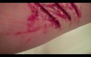 Scratches