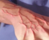 Kryptonitrot2