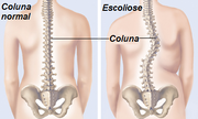 DesviosColuna4